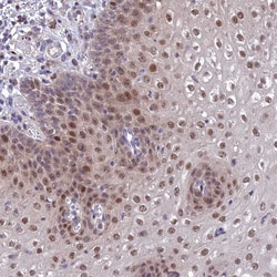 Invitrogen ANR52 Polyclonal Antibody 100 &mu;L; Unconjugated:Antibodies,