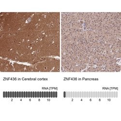 Invitrogen ZNF436 Polyclonal Antibody 100 &mu;L; Unconjugated:Antibodies,