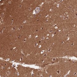 Invitrogen ZNF436 Polyclonal Antibody 100 &mu;L; Unconjugated:Antibodies,