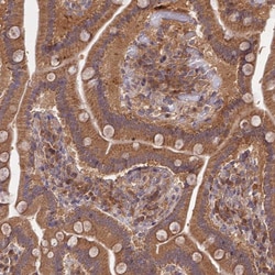 Invitrogen TRIM40 Polyclonal Antibody 100 &mu;L; Unconjugated:Antibodies,