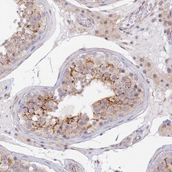 Invitrogen VSTM2L Polyclonal Antibody 100 &mu;L; Unconjugated:Antibodies,