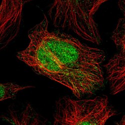 Invitrogen C2orf49 Polyclonal Antibody 100 &mu;L | Buy Online | Invitrogen&trade; | Fisher Scientific