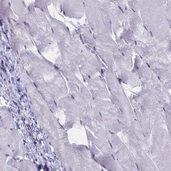 Invitrogen SRSF7 Polyclonal Antibody 100 &mu;L; Unconjugated:Antibodies,