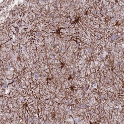 Invitrogen TAS2R38 Polyclonal Antibody 100 &mu;L; Unconjugated:Antibodies,