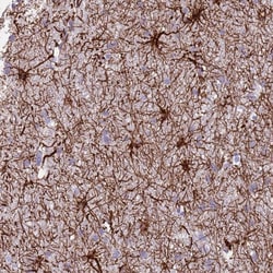 Invitrogen TAS2R38 Polyclonal Antibody 100 &mu;L; Unconjugated:Antibodies,