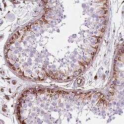Invitrogen TAS2R38 Polyclonal Antibody 100 &mu;L; Unconjugated:Antibodies,