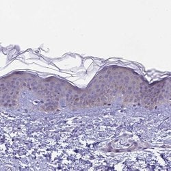 Invitrogen ARHGEF37 Polyclonal Antibody 100 &mu;L; Unconjugated:Antibodies,