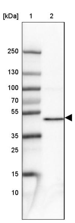 Invitrogen PPME1 Polyclonal Antibody 100 &mu;L | Buy Online | Invitrogen&trade; | Fisher Scientific