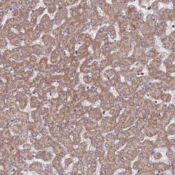 Invitrogen ACAD8 Polyclonal Antibody 100 &mu;L | Buy Online | Invitrogen&trade; | Fisher Scientific