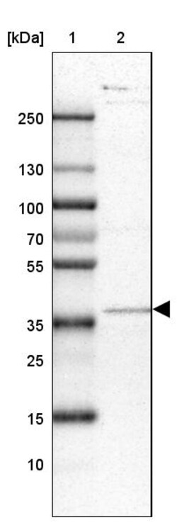 Invitrogen ACAD8 Polyclonal Antibody 100 &mu;L | Buy Online | Invitrogen&trade; | Fisher Scientific