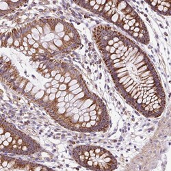 Invitrogen CEP290 Polyclonal Antibody 100 &mu;L; Unconjugated:Antibodies,