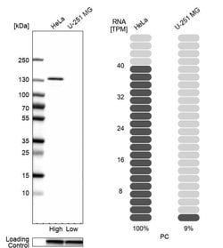 Invitrogen Pyruvate Carboxylase Polyclonal Antibody 100 &mu;L; Unconjugated:Anticuerpos