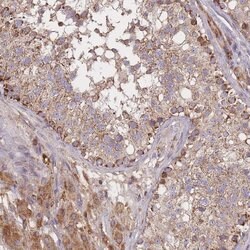 Invitrogen PTPMT1 Polyclonal Antibody 100 &mu;L; Unconjugated:Antibodies,