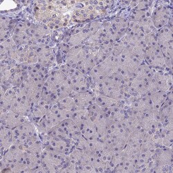 Invitrogen ZIP13 Polyclonal Antibody 100 &mu;L; Unconjugated:Antibodies,