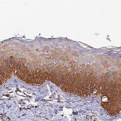 Invitrogen ZIP13 Polyclonal Antibody 100 &mu;L; Unconjugated:Antibodies,