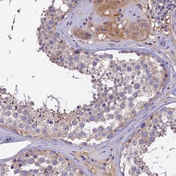 Invitrogen ZIP13 Polyclonal Antibody 100 &mu;L; Unconjugated:Antibodies,
