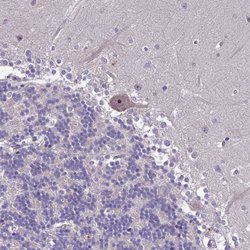 Invitrogen ZNF333 Polyclonal Antibody 100 &mu;L; Unconjugated:Antibodies,
