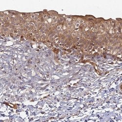 Invitrogen INO80D Polyclonal Antibody 100 &mu;L; Unconjugated:Antibodies,