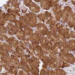 Invitrogen RHBDD3 Polyclonal Antibody 100 &mu;L; Unconjugated:Antibodies,