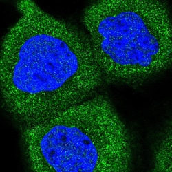 Invitrogen PPP6R1 Polyclonal Antibody 100 &mu;L; Unconjugated:Antibodies,