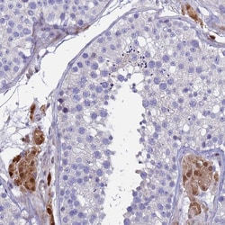 Invitrogen PPP6R1 Polyclonal Antibody 100 &mu;L; Unconjugated:Antibodies,