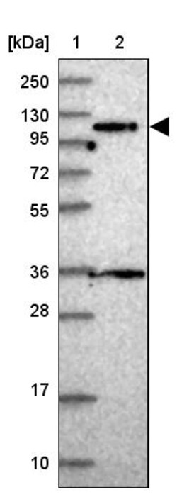 Invitrogen&trade;&nbsp;PPP6R1 Polyclonal Antibody