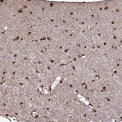 Invitrogen DBNDD2 Polyclonal Antibody 100 &mu;L; Unconjugated:Antibodies,