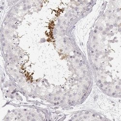 Invitrogen SPATA24 Polyclonal Antibody 100 &mu;L; Unconjugated:Antibodies,