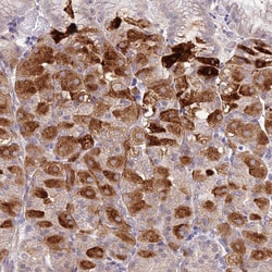 Invitrogen CP013 Polyclonal Antibody 100 &mu;L; Unconjugated:Antibodies,