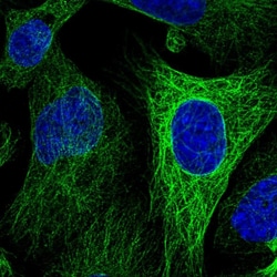Invitrogen WWC2 Polyclonal Antibody 100 &mu;L; Unconjugated:Antibodies,