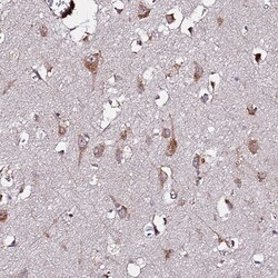 Invitrogen WWC2 Polyclonal Antibody 100 &mu;L; Unconjugated:Antibodies,