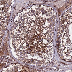 Invitrogen WWC2 Polyclonal Antibody 100 &mu;L; Unconjugated:Antibodies,