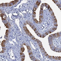Invitrogen RABL2A Polyclonal Antibody 100 &mu;L; Unconjugated:Antibodies,
