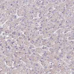 Invitrogen ANKRD50 Polyclonal Antibody 100 &mu;L; Unconjugated:Antibodies,