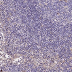 Invitrogen ANKRD50 Polyclonal Antibody 100 &mu;L; Unconjugated:Antibodies,