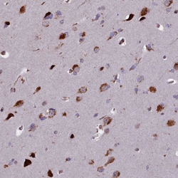 Invitrogen GLYATL3 Polyclonal Antibody 100 &mu;L; Unconjugated:Antibodies,
