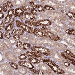 Invitrogen FECH Polyclonal Antibody 100 &mu;L; Unconjugated:Antibodies,