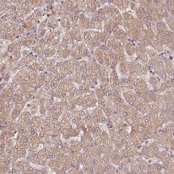 Invitrogen FECH Polyclonal Antibody 100 &mu;L; Unconjugated:Antibodies,