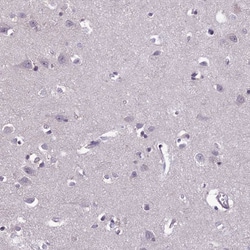 Invitrogen FBRS Polyclonal Antibody 100 &mu;L; Unconjugated:Antibodies,