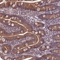 Invitrogen FBRS Polyclonal Antibody 100 &mu;L; Unconjugated:Antibodies,