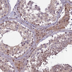 Invitrogen FBRS Polyclonal Antibody 100 &mu;L; Unconjugated:Antibodies,