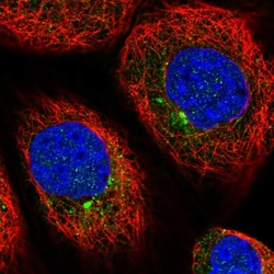 Invitrogen AGTRAP Polyclonal Antibody 100 &mu;L; Unconjugated:Antibodies,