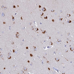 Invitrogen VTI1B Polyclonal Antibody 100 &mu;L; Unconjugated:Antibodies,