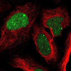 ZNF565 Polyclonal Antibody:Antibodies, Polyclonal