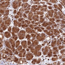 ZNF565 Polyclonal Antibody:Antibodies, Polyclonal