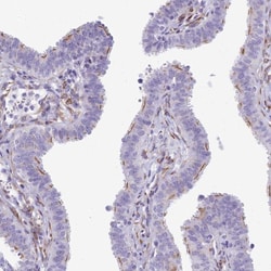 Invitrogen CC2D2A Polyclonal Antibody 100 &mu;L; Unconjugated:Antibodies,