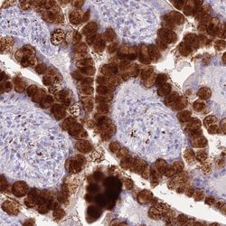 Invitrogen DHDH Polyclonal Antibody 100 &mu;L; Unconjugated:Antibodies,