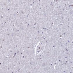 Invitrogen MFSD2B Polyclonal Antibody 100 &mu;L; Unconjugated:Antibodies,