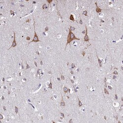 Invitrogen WDR35 Polyclonal Antibody 100 &mu;L; Unconjugated:Antibodies,