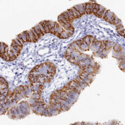 Invitrogen WDR35 Polyclonal Antibody 100 &mu;L; Unconjugated:Antibodies,